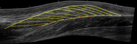 Towards entry "Olfa D’Angelo published a paper on Curvature of gastrocnemius muscle fascicles as function of muscle– tendon complex length and contraction in humans"